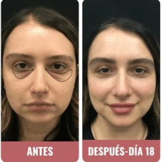 Elena R. | 31 años
