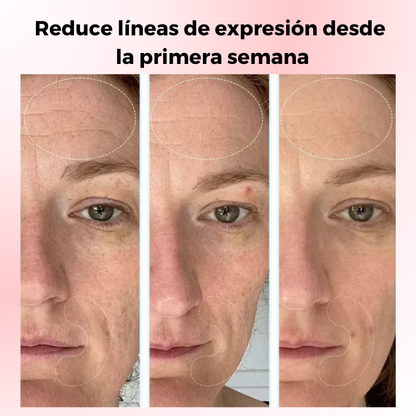 BIODANCE SALUD COREANA- Para quienes buscan mejorar la salud y el aspecto de su piel.