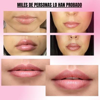 Gloss Plump™ - Aumento de Labios de Forma Natural