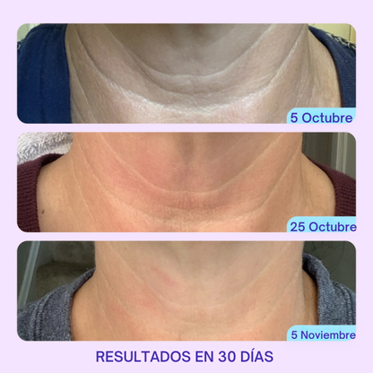 ADIÓS A LA FLACIDEZ Y LAS ARRUGAS DEL CUELLO Y ESCOTE