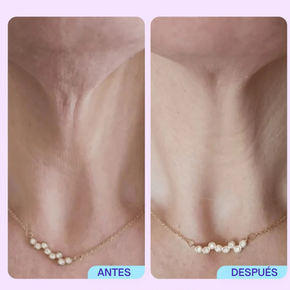 ADIÓS A LA FLACIDEZ Y LAS ARRUGAS DEL CUELLO Y ESCOTE