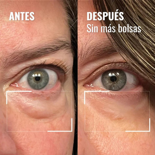 Auralift - Adiós bolsas y ojeras en 2 semanas