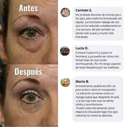 Auralift - Adiós bolsas y ojeras en 2 semanas