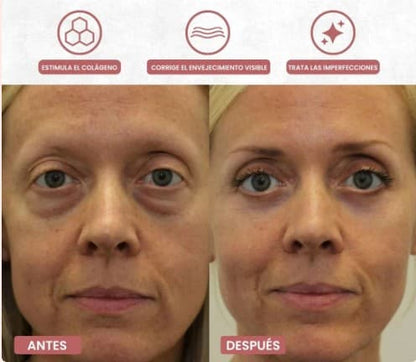 Auralift - Adiós bolsas y ojeras en 2 semanas