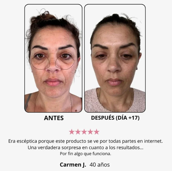 Hace 1 mes vs Ahora