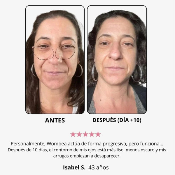 Hace 4 meses vs Ahora