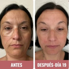 Silvia A. | 41 años
