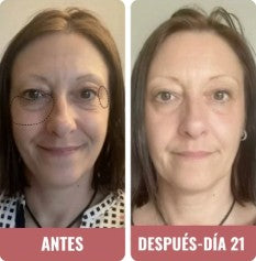 Ana T. | 47 años